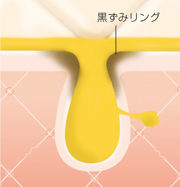 あなたの毛穴悩みはどのタイプ 7タイプの対策法を3分で解説 Bis ビス